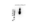 Hemoglobin beta C Antibody in Western Blot (WB)