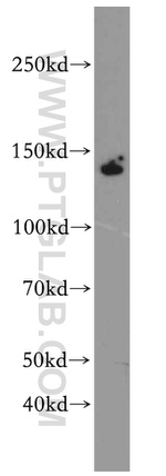 ZBTB40 Antibody in Western Blot (WB)
