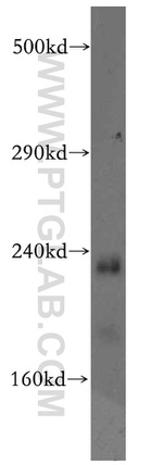 MED12 Antibody in Western Blot (WB)