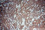 ZC3H4 Antibody in Immunohistochemistry (Paraffin) (IHC (P))