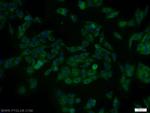 DAPK2 Antibody in Immunocytochemistry (ICC/IF)