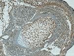 TNS3 Antibody in Immunohistochemistry (Paraffin) (IHC (P))