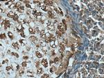 TNS3 Antibody in Immunohistochemistry (Paraffin) (IHC (P))