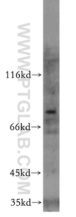 MYSM1 Antibody in Western Blot (WB)