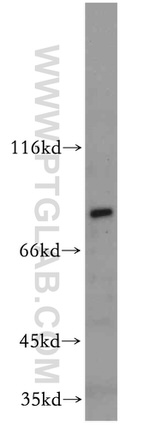 MYSM1 Antibody in Western Blot (WB)