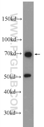 MYSM1 Antibody in Western Blot (WB)