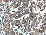 GAB3 Antibody in Immunohistochemistry (Paraffin) (IHC (P))