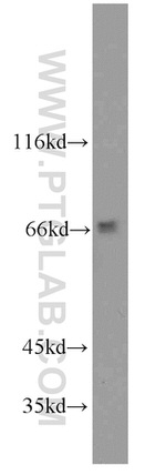 GAB3 Antibody in Western Blot (WB)