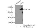 CD45 Antibody in Immunoprecipitation (IP)