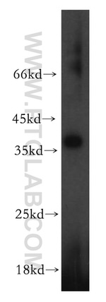 HAUS4 Antibody in Western Blot (WB)