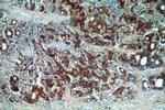 EEF2 Antibody in Immunohistochemistry (Paraffin) (IHC (P))