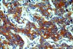 EEF2 Antibody in Immunohistochemistry (Paraffin) (IHC (P))