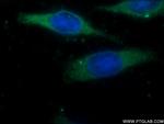 OVCA1 Antibody in Immunocytochemistry (ICC/IF)