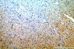 OVCA1 Antibody in Immunohistochemistry (Paraffin) (IHC (P))