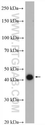 OVCA1 Antibody in Western Blot (WB)