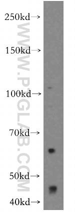 OVCA1 Antibody in Western Blot (WB)