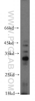 C14orf94 Antibody in Western Blot (WB)