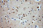 ZCCHC11 Antibody in Immunohistochemistry (Paraffin) (IHC (P))