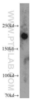 ZCCHC11 Antibody in Western Blot (WB)