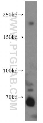 ZCCHC11 Antibody in Western Blot (WB)