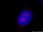 RRP8 Antibody in Immunocytochemistry (ICC/IF)