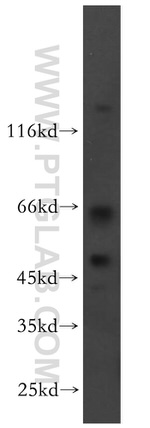 RRP8 Antibody in Western Blot (WB)