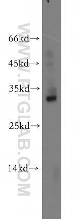 BIRC8 Antibody in Western Blot (WB)