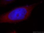 SHP2 Antibody in Immunocytochemistry (ICC/IF)