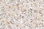 SHP2 Antibody in Immunohistochemistry (Paraffin) (IHC (P))