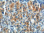 GPR81 Antibody in Immunohistochemistry (Paraffin) (IHC (P))