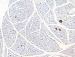 GPR81 Antibody in Immunohistochemistry (Paraffin) (IHC (P))