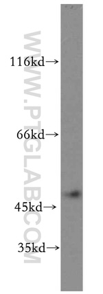 SLC25A23 Antibody in Western Blot (WB)
