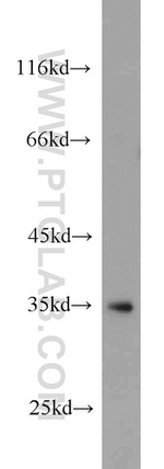 STEAP1 Antibody in Western Blot (WB)