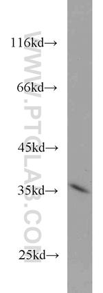 STEAP1 Antibody in Western Blot (WB)