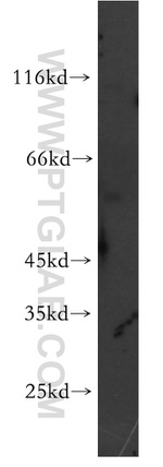 STEAP2 Antibody in Western Blot (WB)