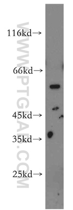 STEAP2 Antibody in Western Blot (WB)