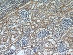 SLIT2 Antibody in Immunohistochemistry (Paraffin) (IHC (P))