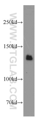 SLIT2 Antibody in Western Blot (WB)