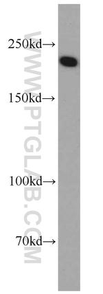 SLIT2 Antibody in Western Blot (WB)