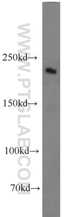 ROBO1 Antibody in Western Blot (WB)