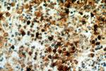 TOP2A Antibody in Immunohistochemistry (Paraffin) (IHC (P))