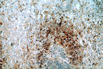 TOP2A Antibody in Immunohistochemistry (Paraffin) (IHC (P))