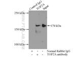 TOP2A Antibody in Immunoprecipitation (IP)