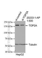 TOP2A Antibody in Western Blot (WB)