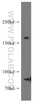 TOP2A Antibody in Western Blot (WB)