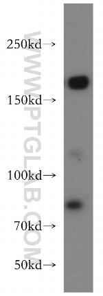 TOP2A Antibody in Western Blot (WB)