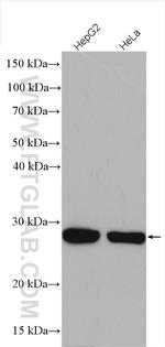 CSNK2B Antibody in Western Blot (WB)