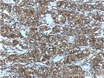 IGF1R beta chain Antibody in Immunohistochemistry (Paraffin) (IHC (P))