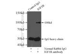 IGF1R beta chain Antibody in Immunoprecipitation (IP)