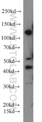 IGF1R beta chain Antibody in Western Blot (WB)